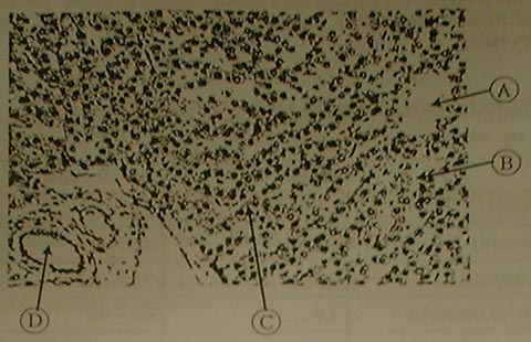 Liver biopsy histology